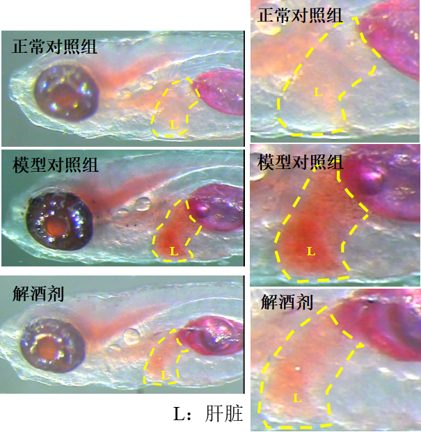 利用斑马鱼模型评价疏肝解酒（酒精性脂肪肝防治）功效